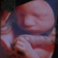 ultrasound clinics minneapolis Enlightened 4D Imaging & Photography