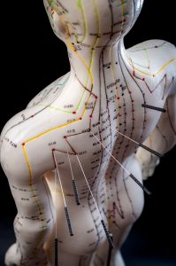 acupuncture schools in minneapolis Acupuncture and Chinese Medicine Center